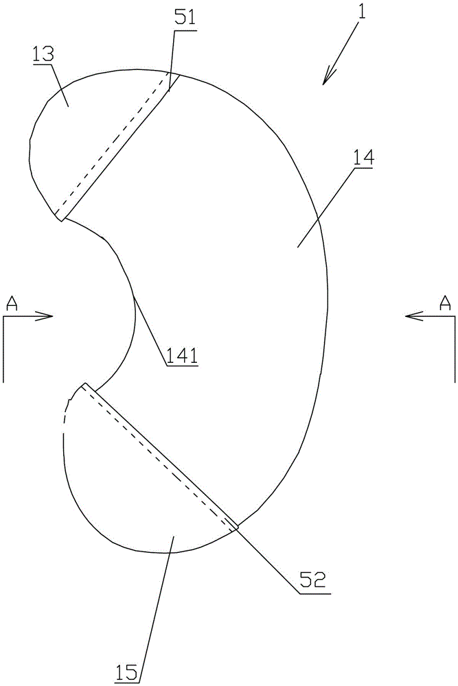 Kidney sleeve device for treating ruptured kidney and method of use thereof