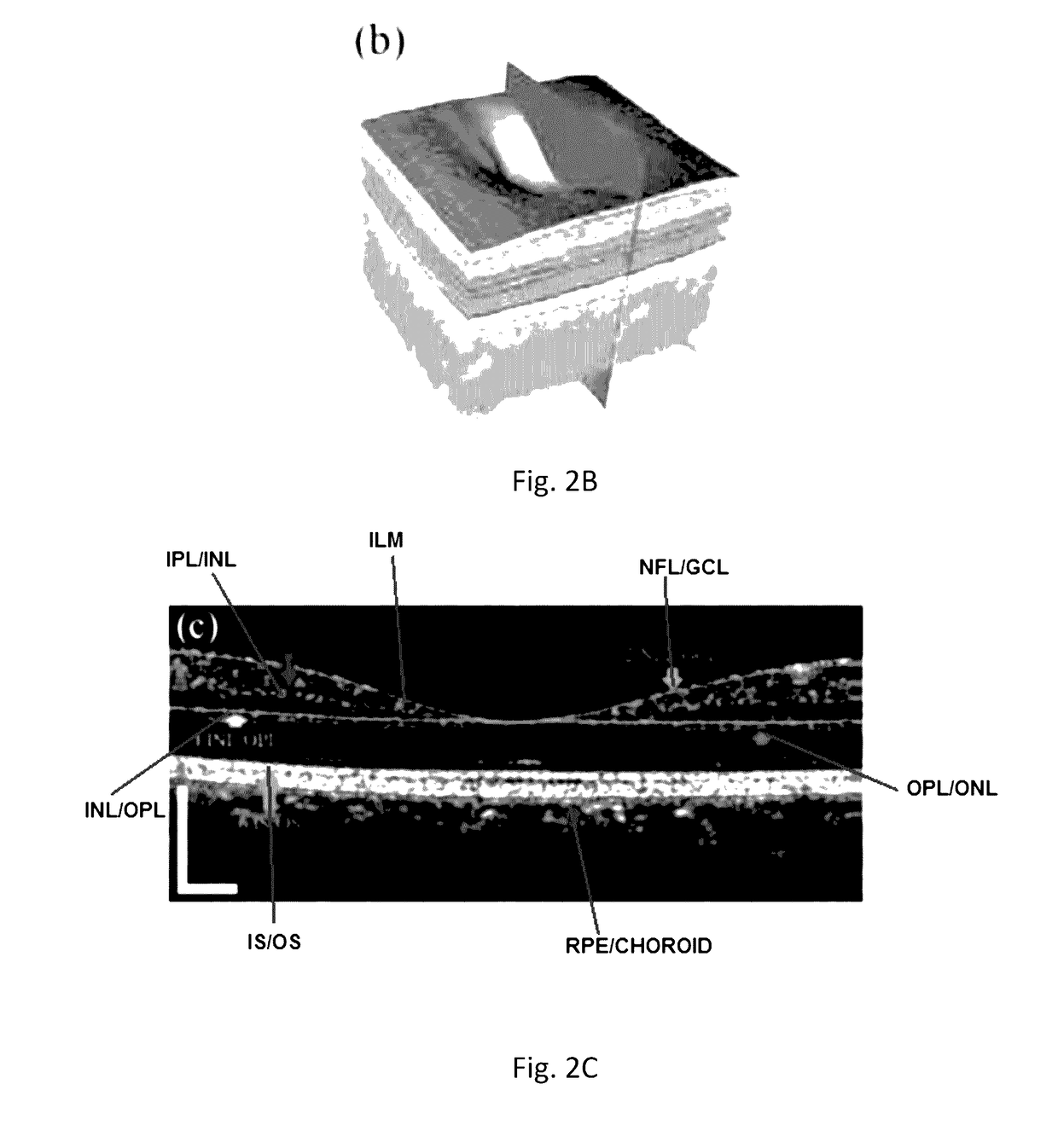 Automatic three-dimensional segmentation method for oct and doppler oct angiography