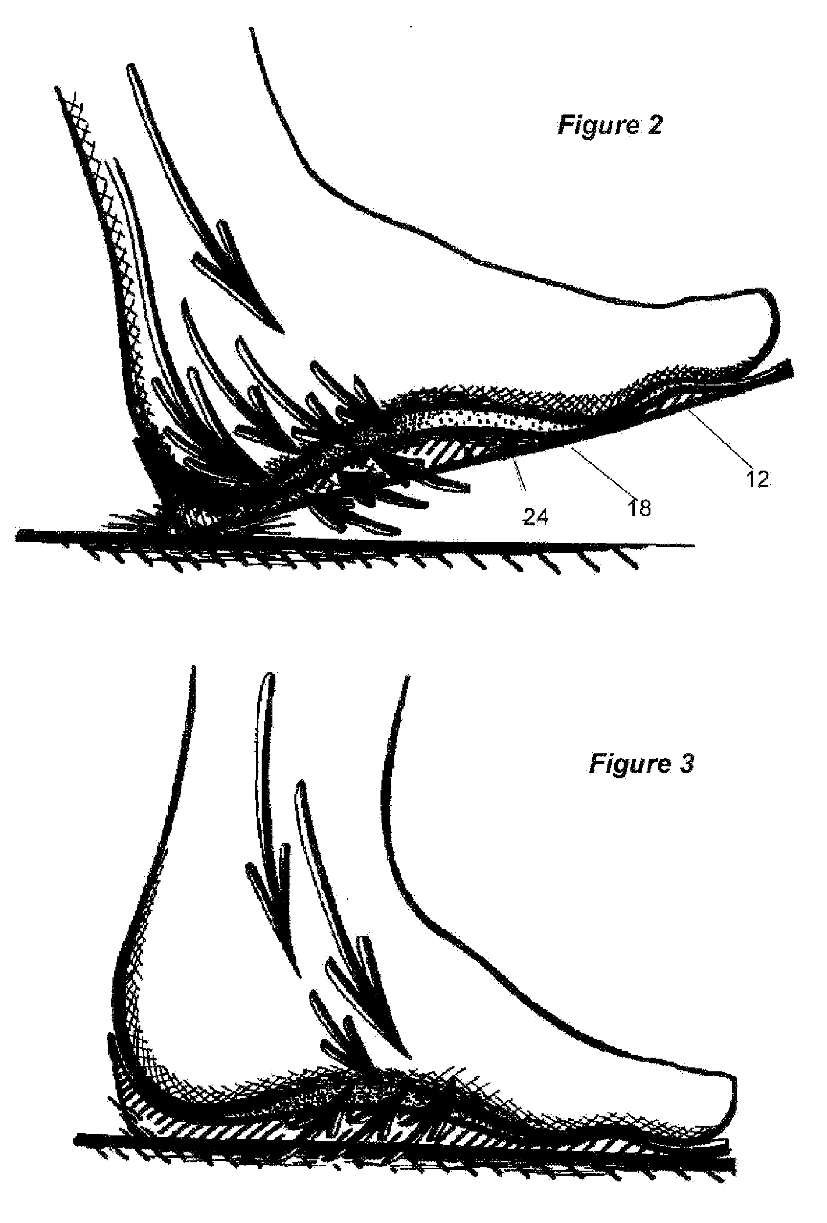 Orthotic device