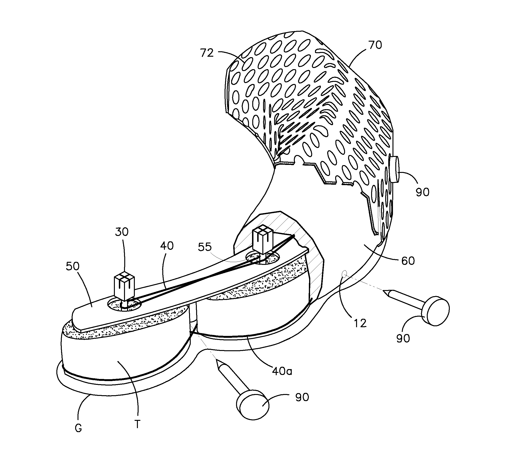 Dental prosthesis for cattle