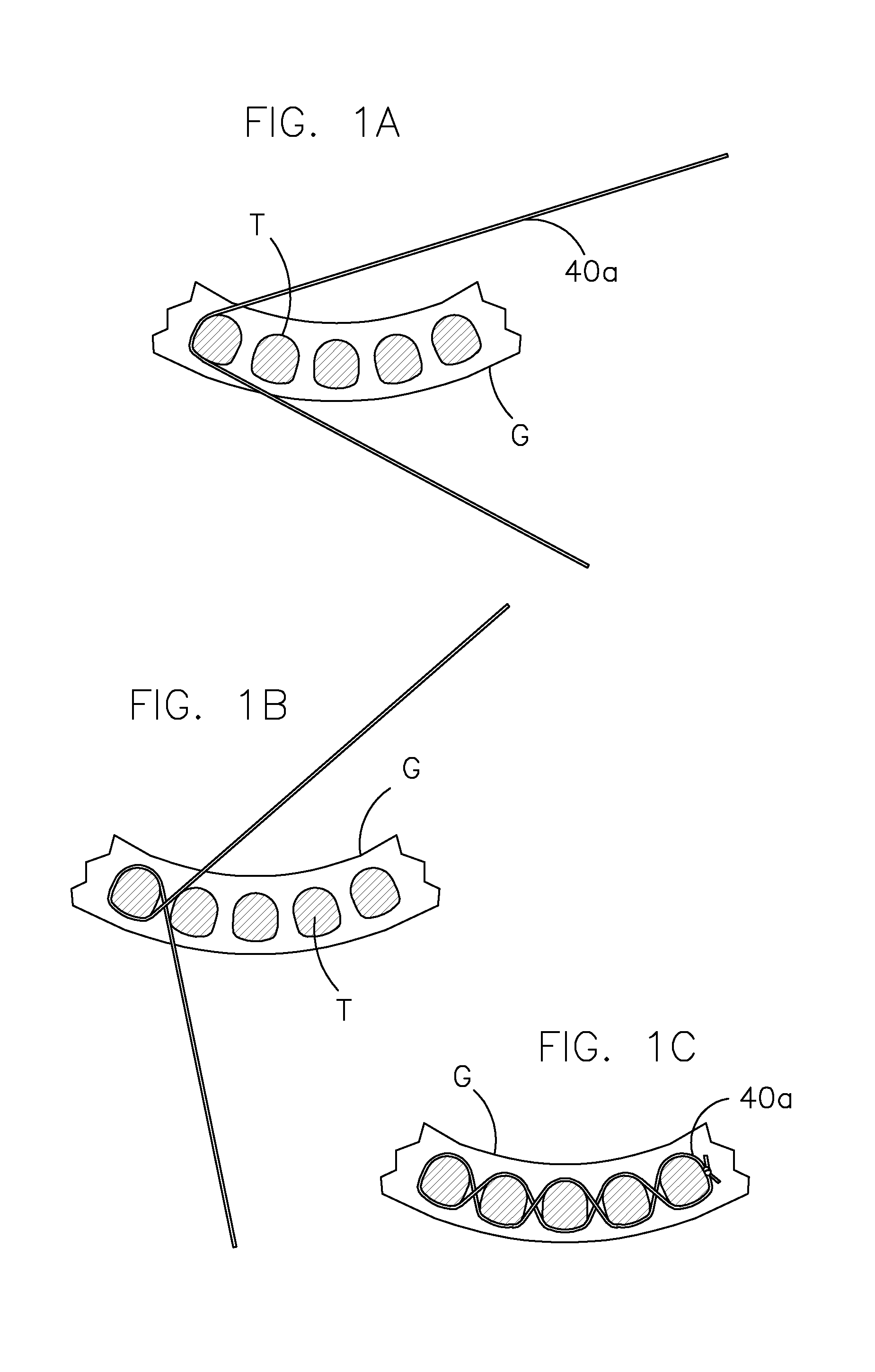 Dental prosthesis for cattle