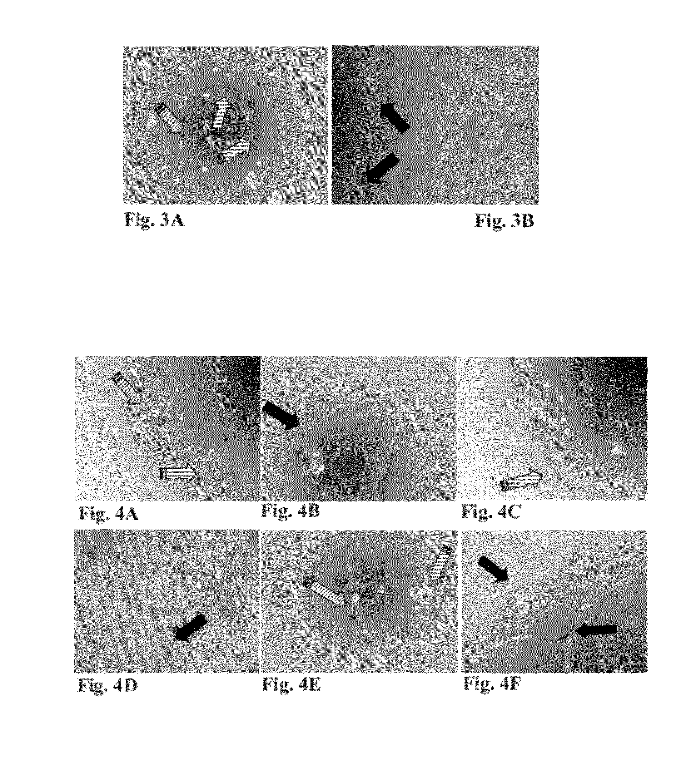 Viral inactivated platelet extract, use and preparation thereof