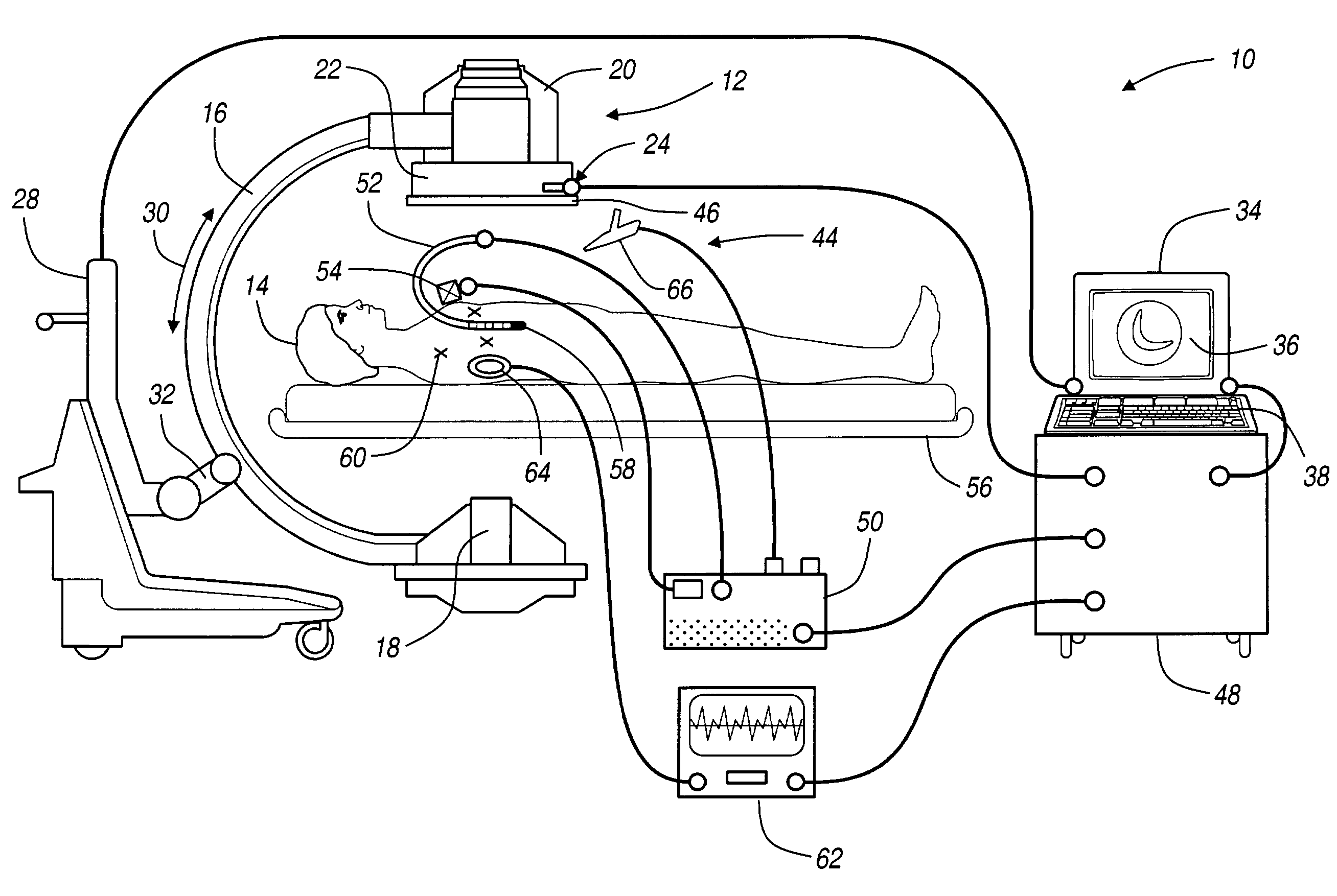 Navigation system for cardiac therapies