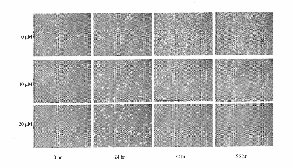 Application of 2-imino-phenylate-5-(2-hydroxy-benzyl)-1,3-thiazole-4-ketone in preparing anti-cerebral cancer medicaments