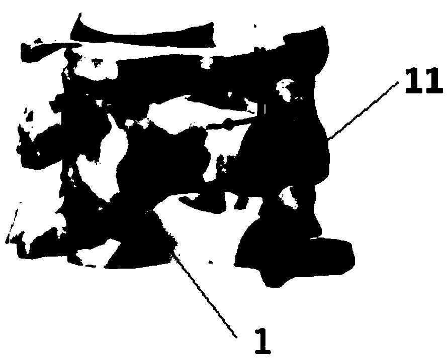 Method for manufacturing 3D printing guide plate for single-open-door cervical vertebra surgery