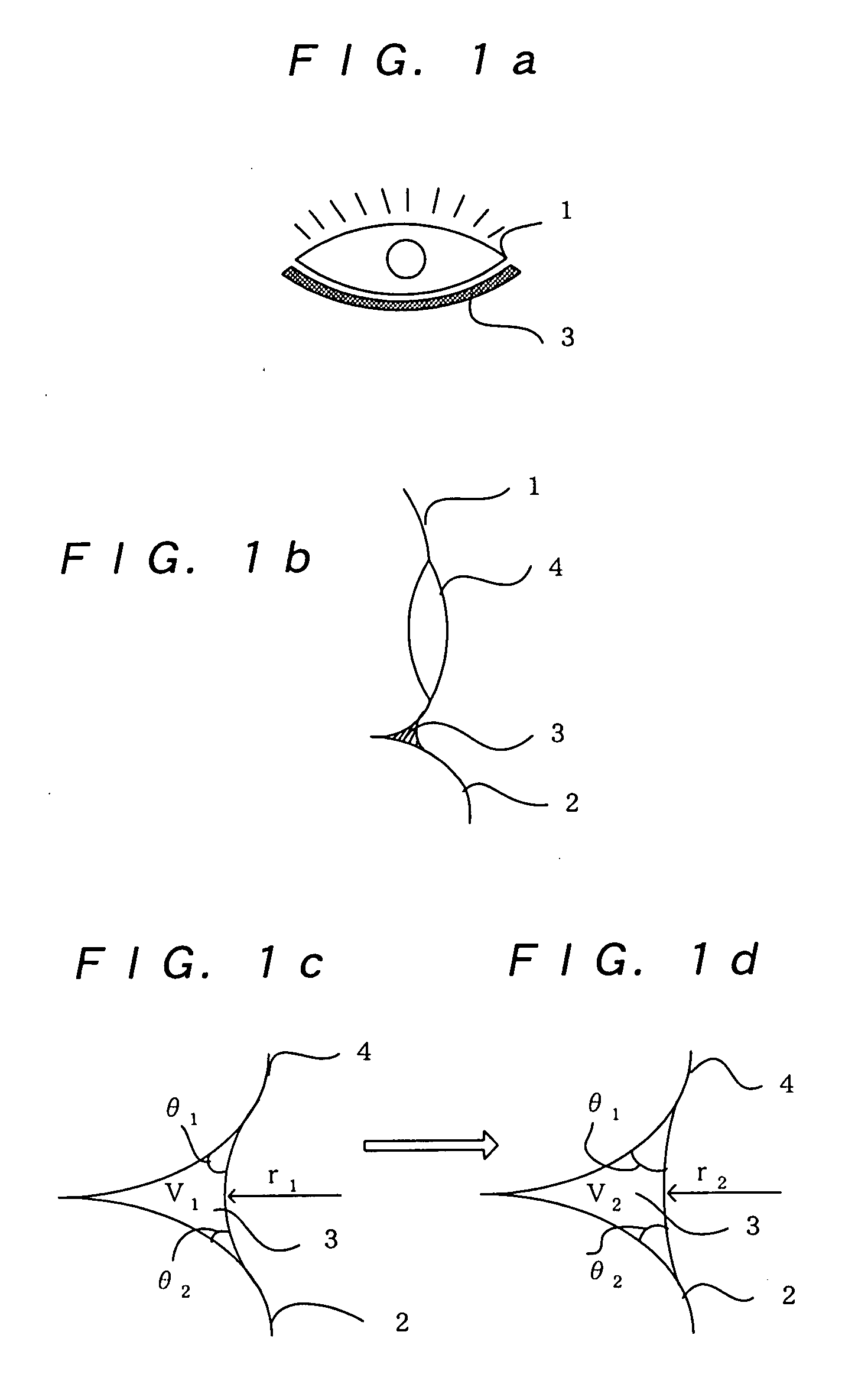 Ophthalmic apparatus