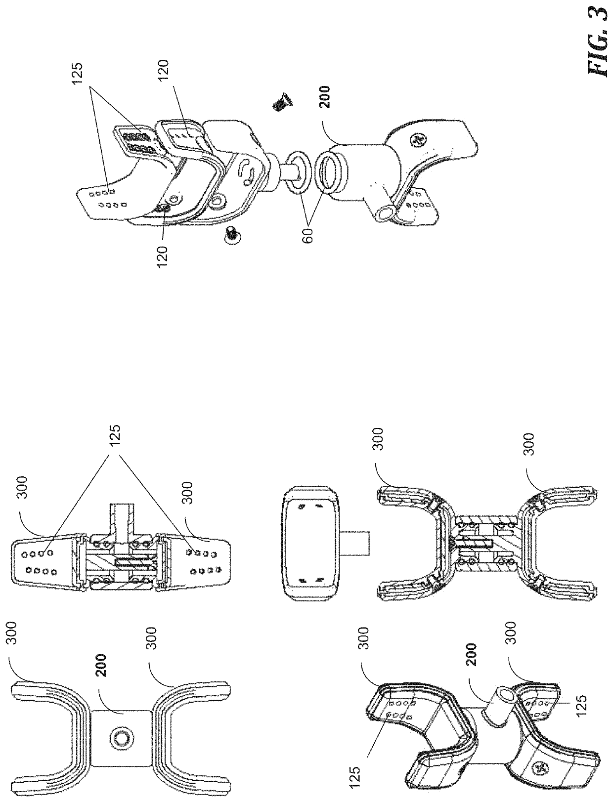 Apparatus for dental irrigation