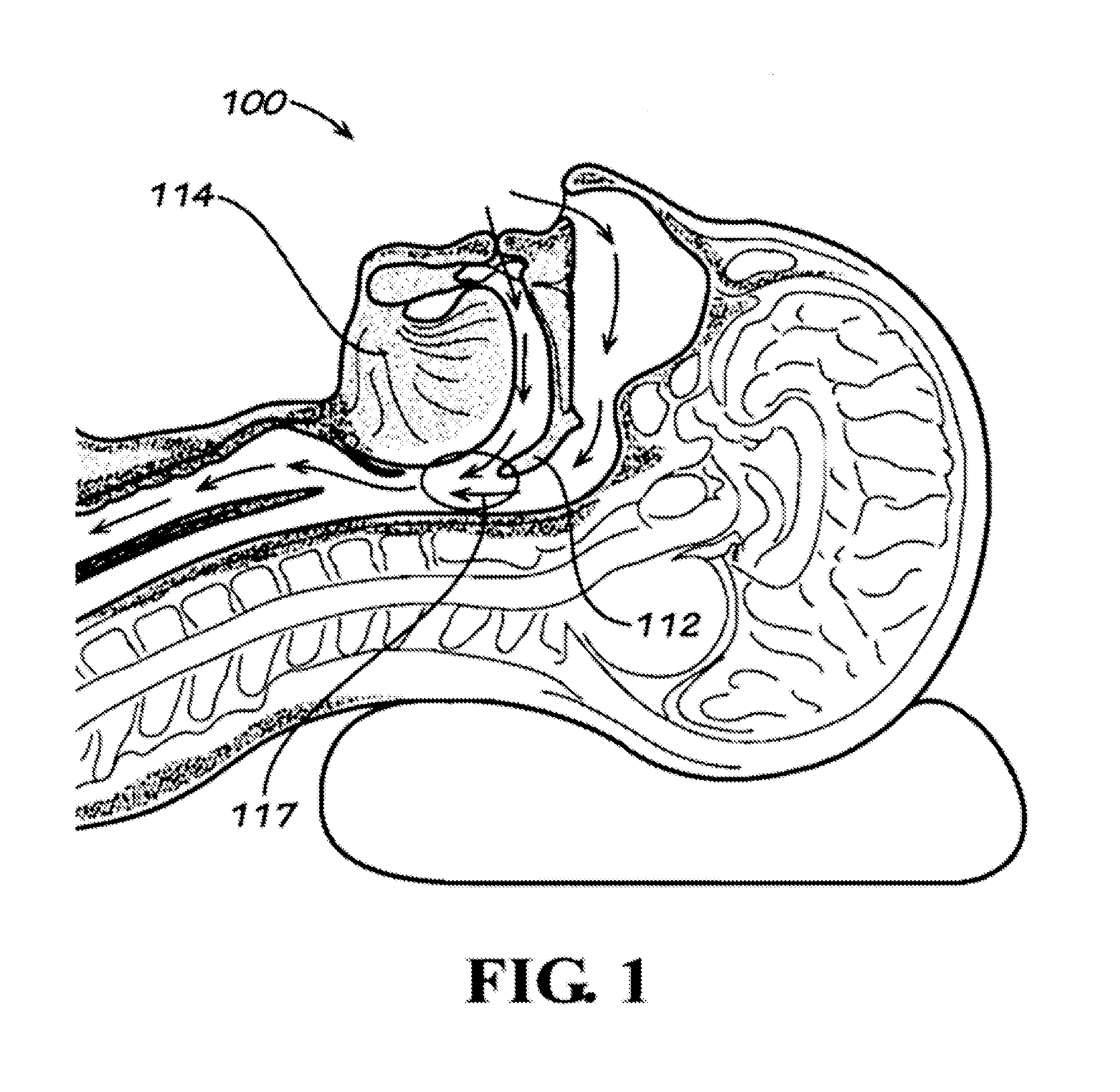 Snoring and obstructive sleep apnea prevention and treatment device