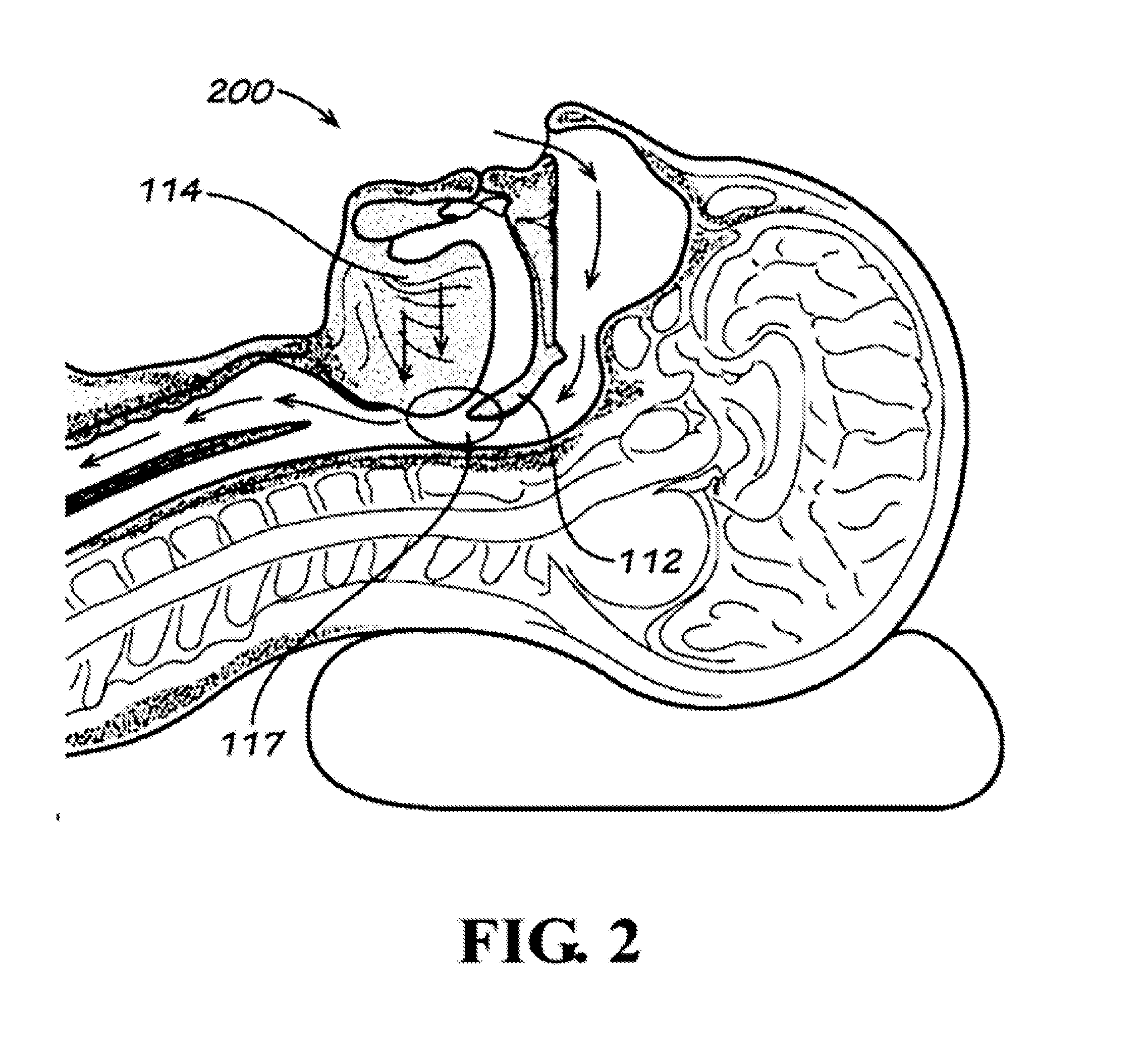 Snoring and obstructive sleep apnea prevention and treatment device