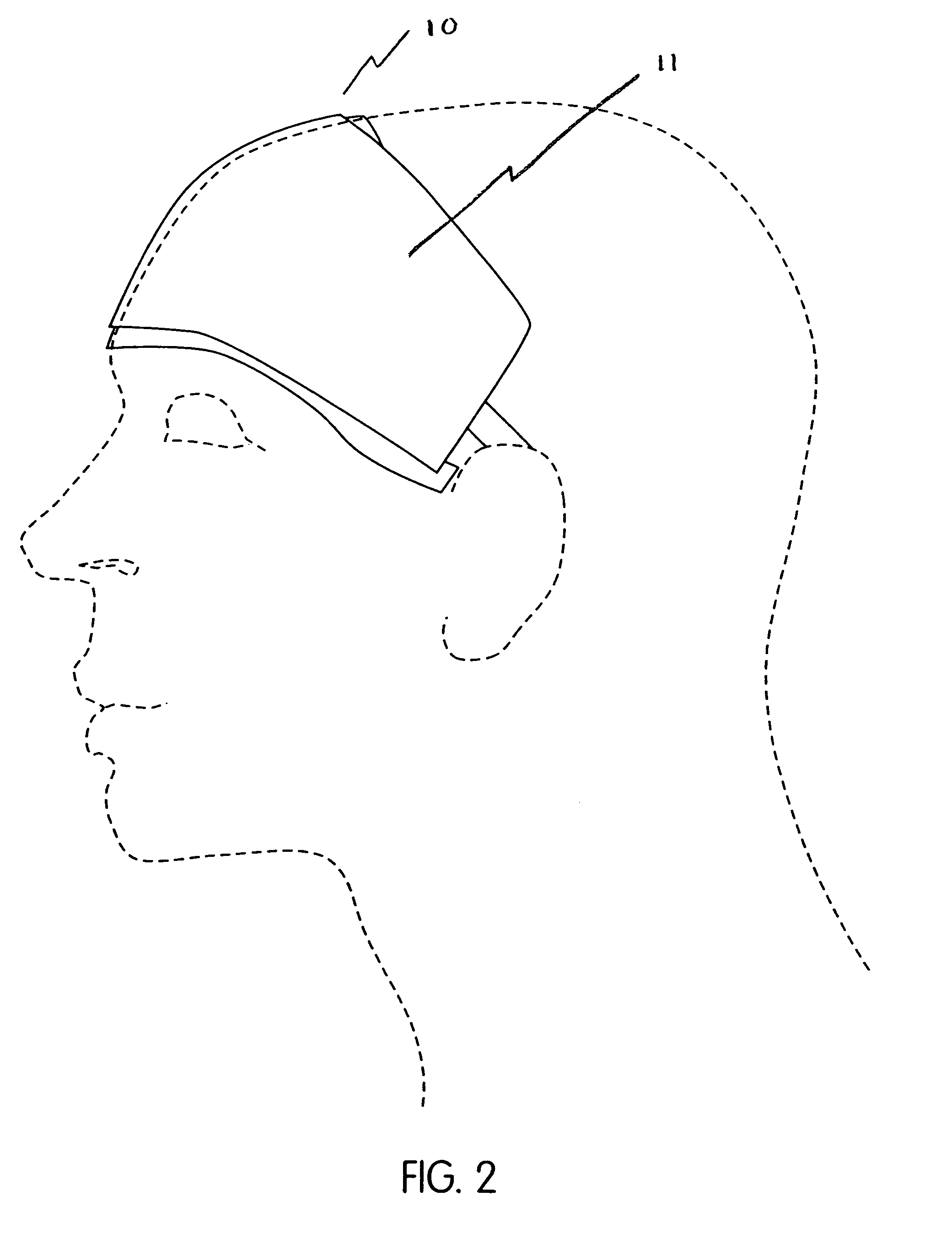 Method and apparatus of noninvasive, regional brain thermal stimuli for the treatment of neurological disorders