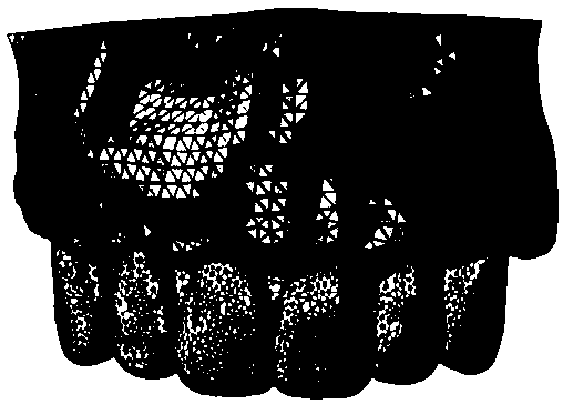 Optimization method of invisible orthodontic appliance