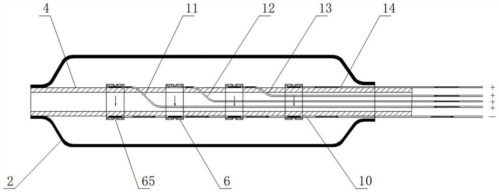 Discharge-controllable shock wave balloon catheter system