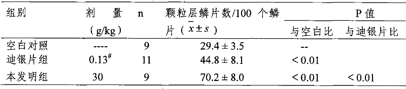 Traditional Chinese medicine composition for treating psoriasis and preparation method thereof