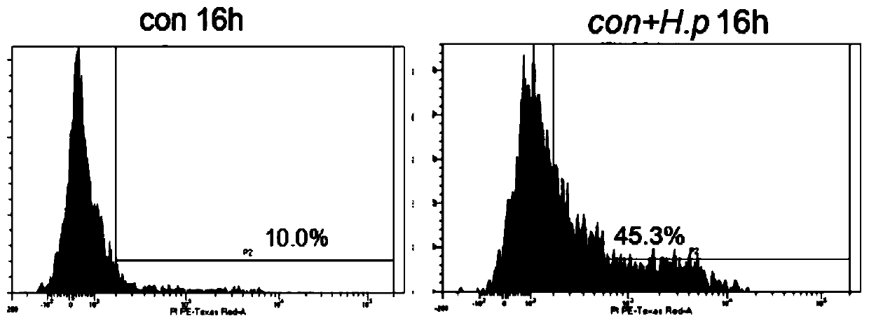 Application of GSDMD inhibitor in preparation of medicine for treating helicobacter pylori infection