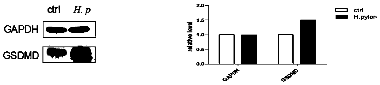 Application of GSDMD inhibitor in preparation of medicine for treating helicobacter pylori infection