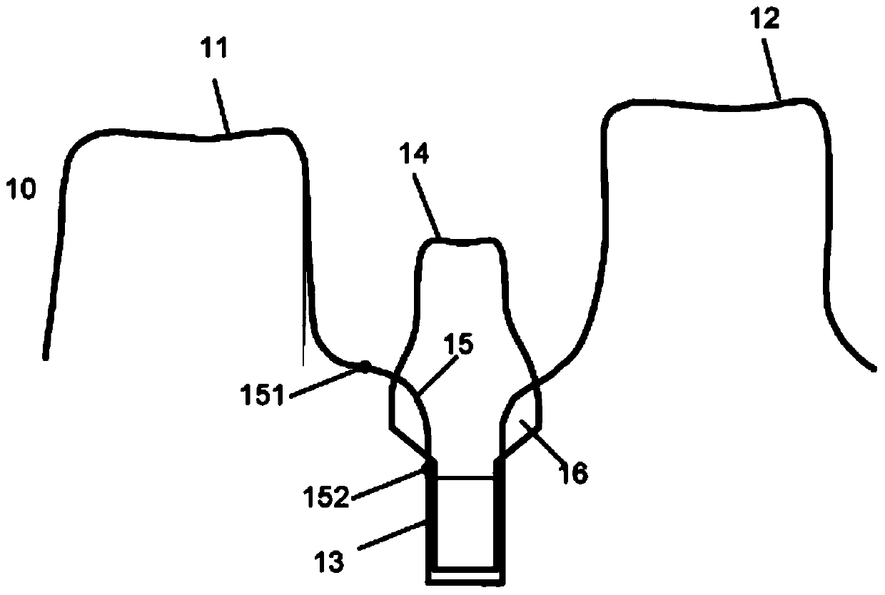 Method of modifying the gingival part of a virtual model of a set of teeth