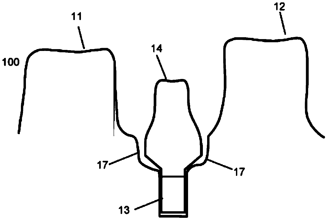 Method of modifying the gingival part of a virtual model of a set of teeth