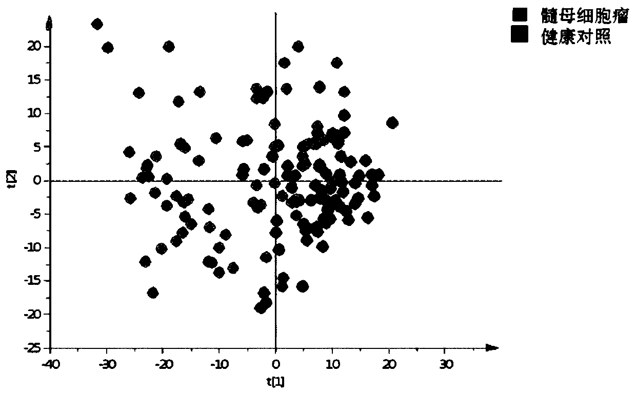 Metabolic marker of medulloblastoma in urine and application thereof