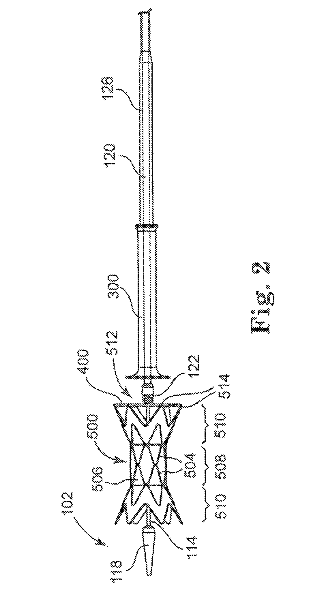 Infundibular reducer device delivery system and related methods