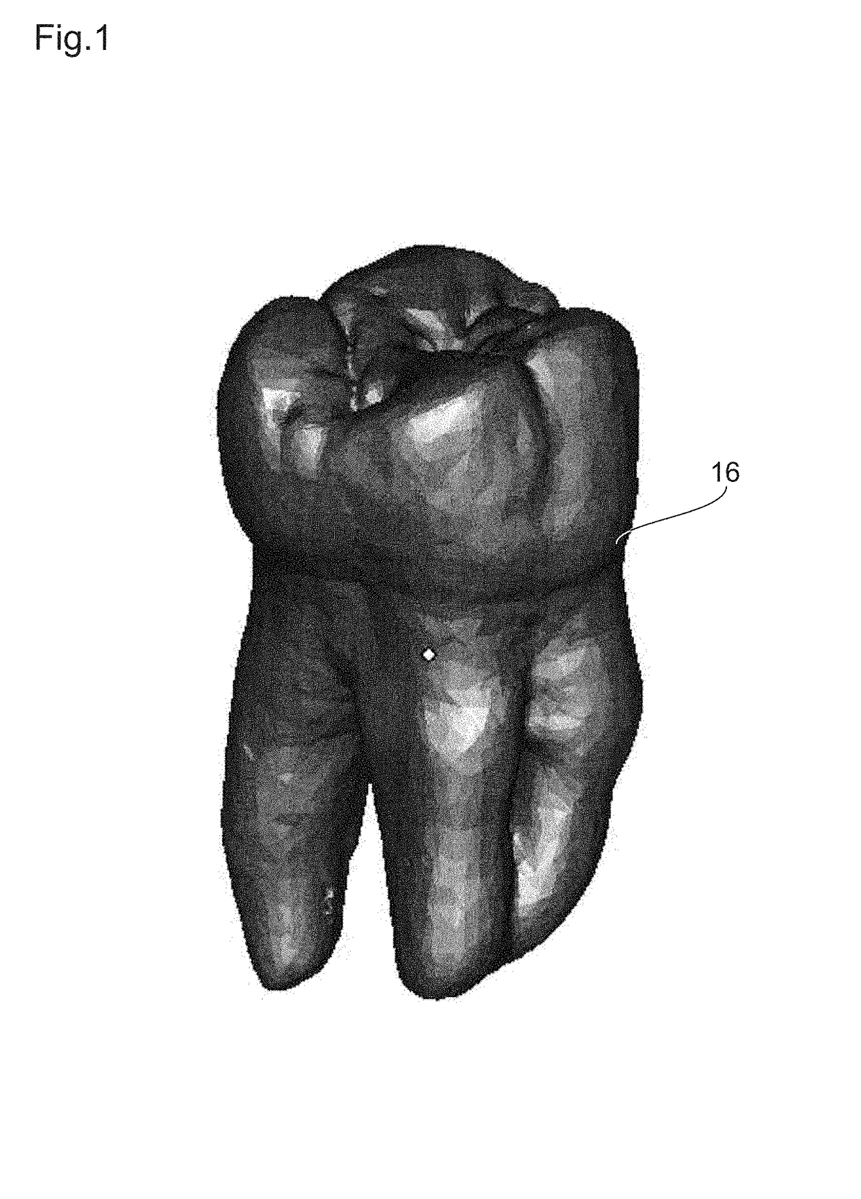 Endodontic treatment simulation system