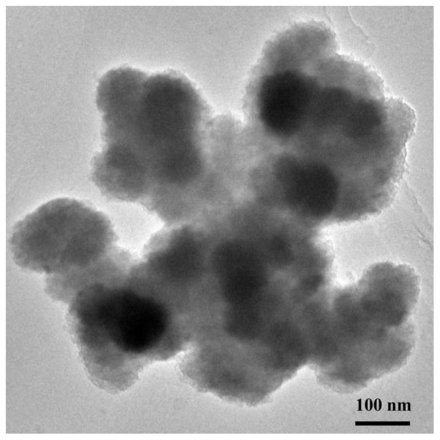 Polydopamine-coated drug-loaded molybdenum disulfide nanosheet and preparation and application thereof