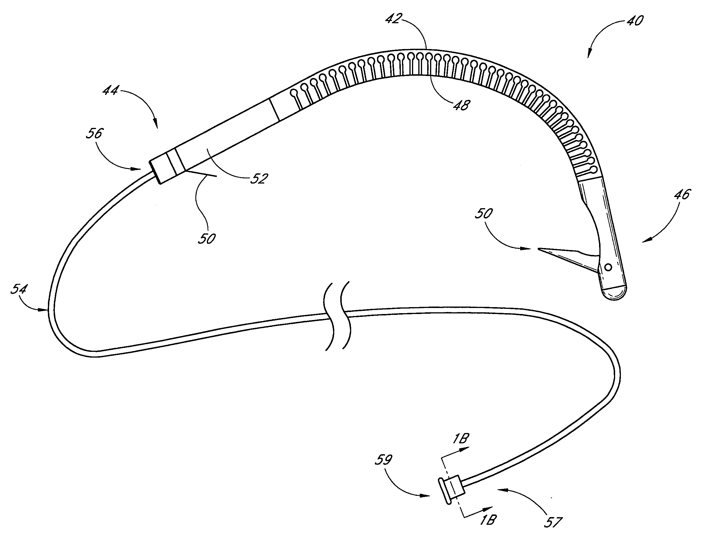 Remotely adjustable coronary sinus implant