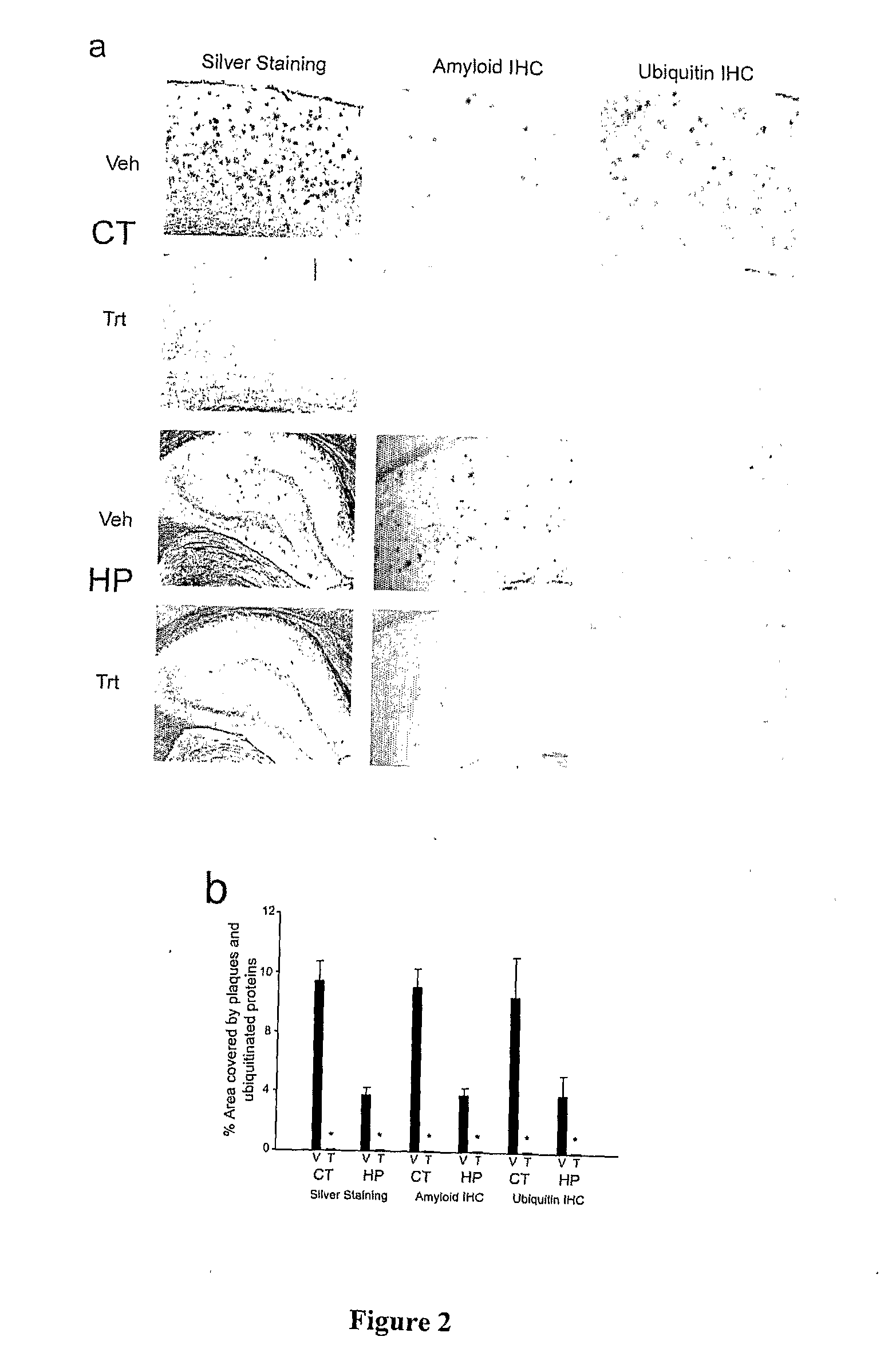 Withania somnifera plant extract and method of preparation thereof