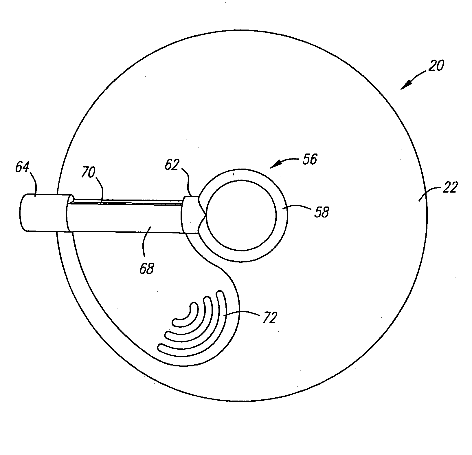 Apparatus and method for delivery of therapeutic and/or diagnostic agents