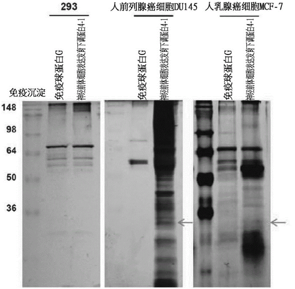 Composition for treatment or metastasis suppression of cancers which includes P34 expression inhibitor or activity inhibitor as active ingredient