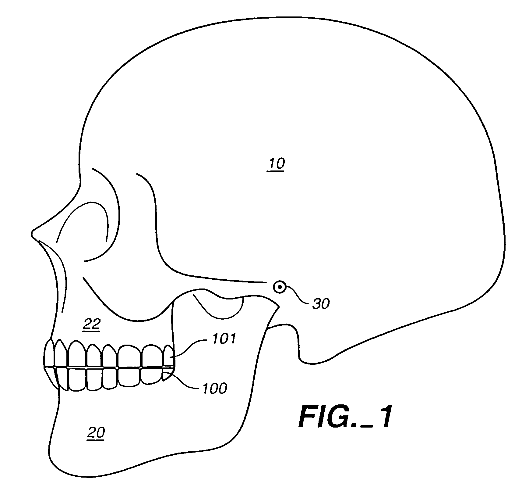 Systems and methods for positioning teeth