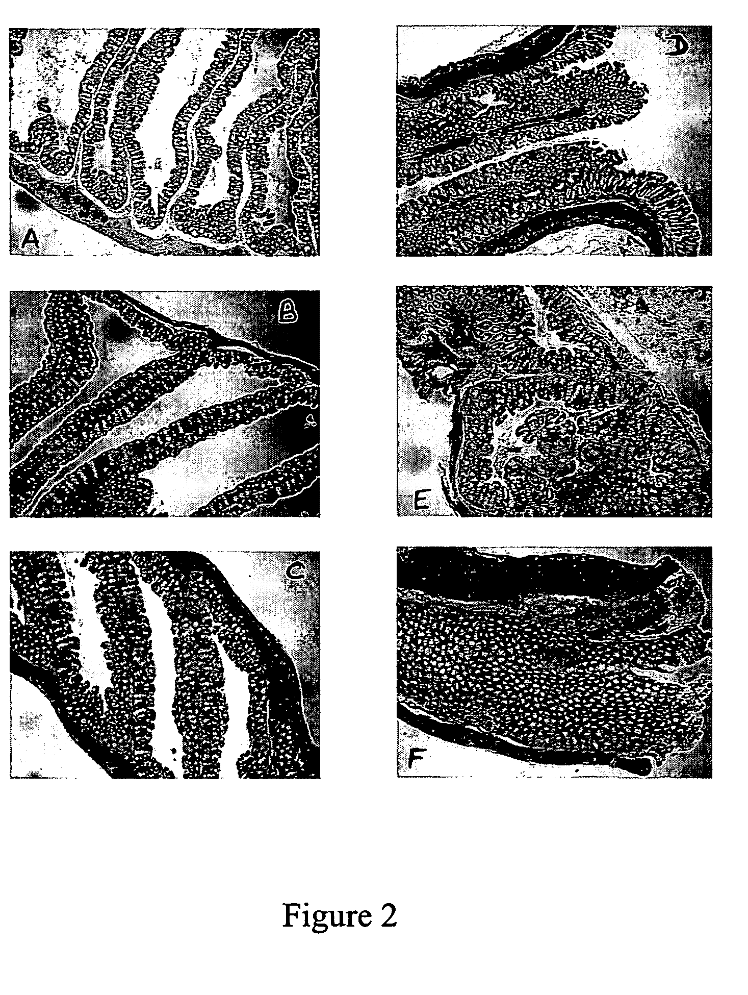 Method for treating inflammatory bowel disease by oral administration of IL-10