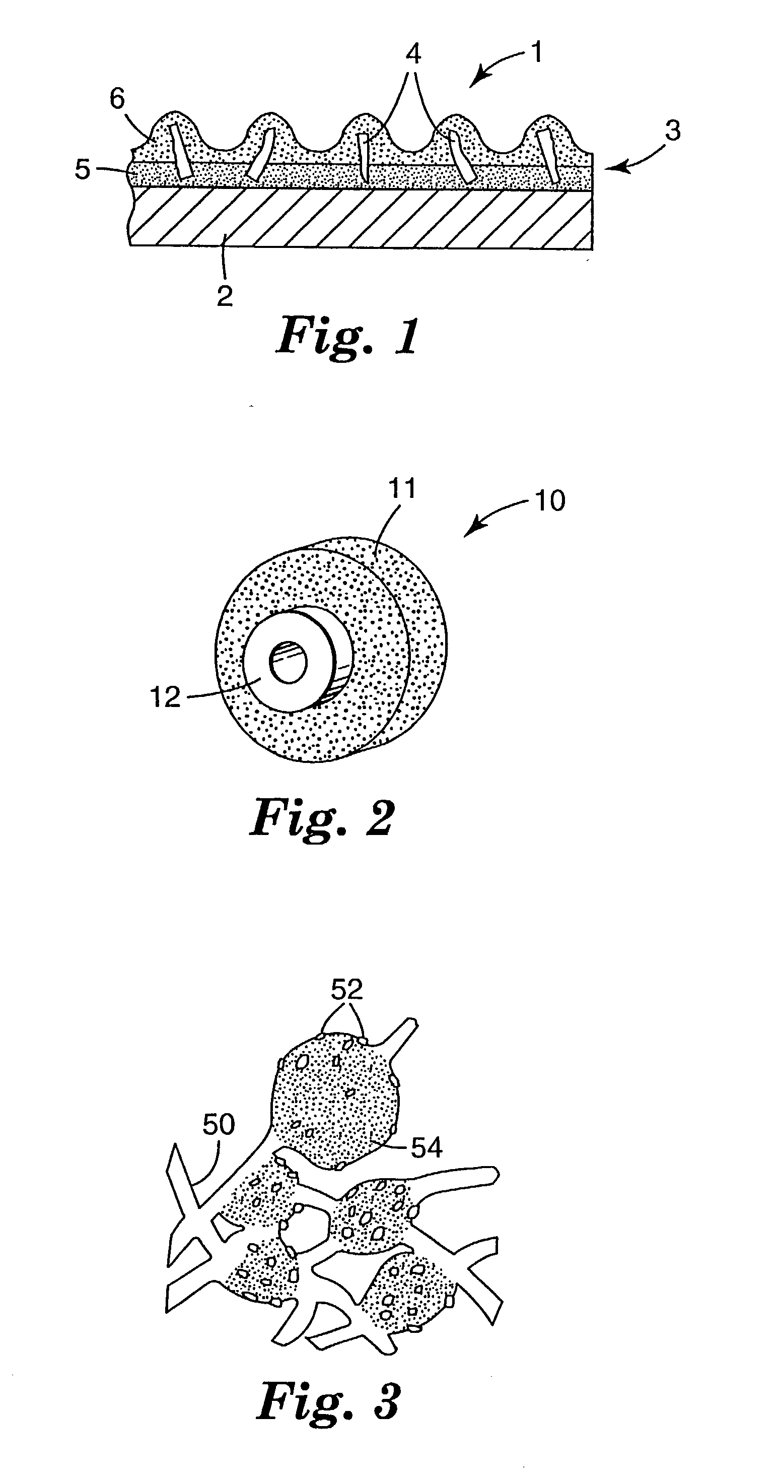 Fused abrasive particles, abrasive articles, and methods of making and using the same