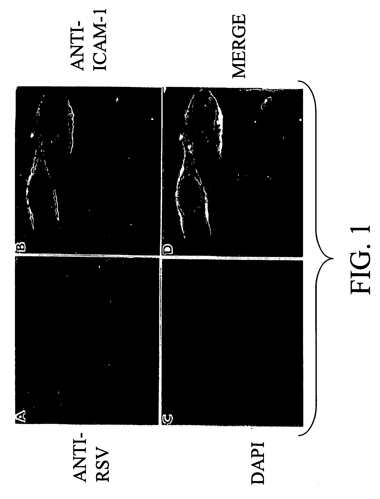 Interrupting the interaction of intercellular adhesion molecule-1 and respiratory syncytial virus for prevention and treatment of infection