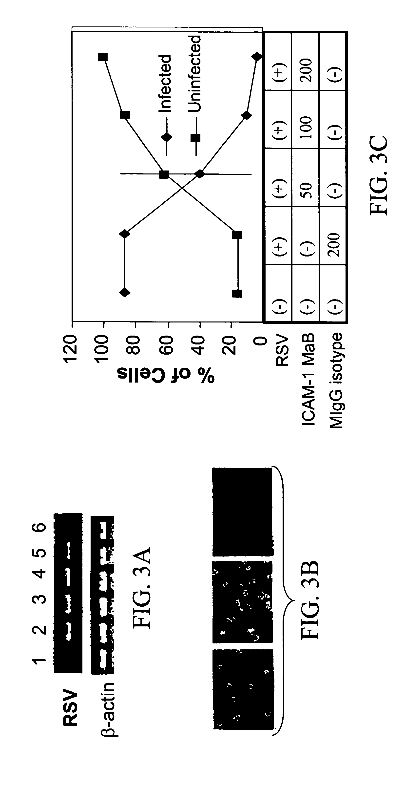 Interrupting the interaction of intercellular adhesion molecule-1 and respiratory syncytial virus for prevention and treatment of infection