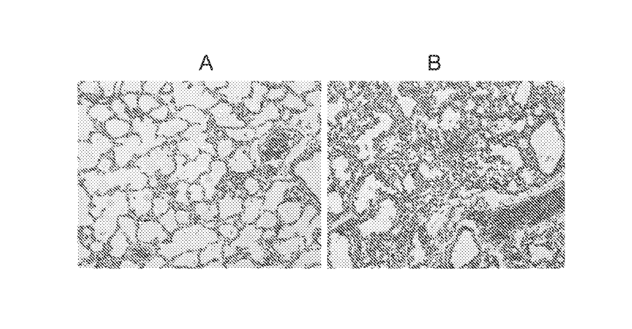 Biological therapeutics for infection-relating disorders or conditions