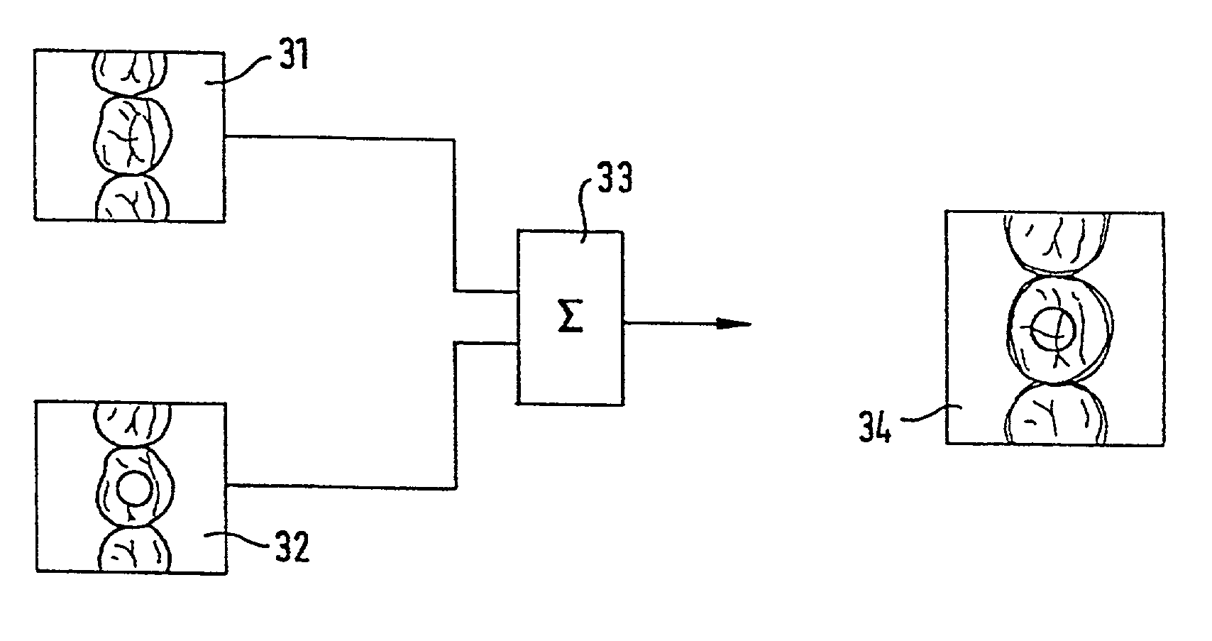 Method for detecting and representing one or more objects, for example teeth