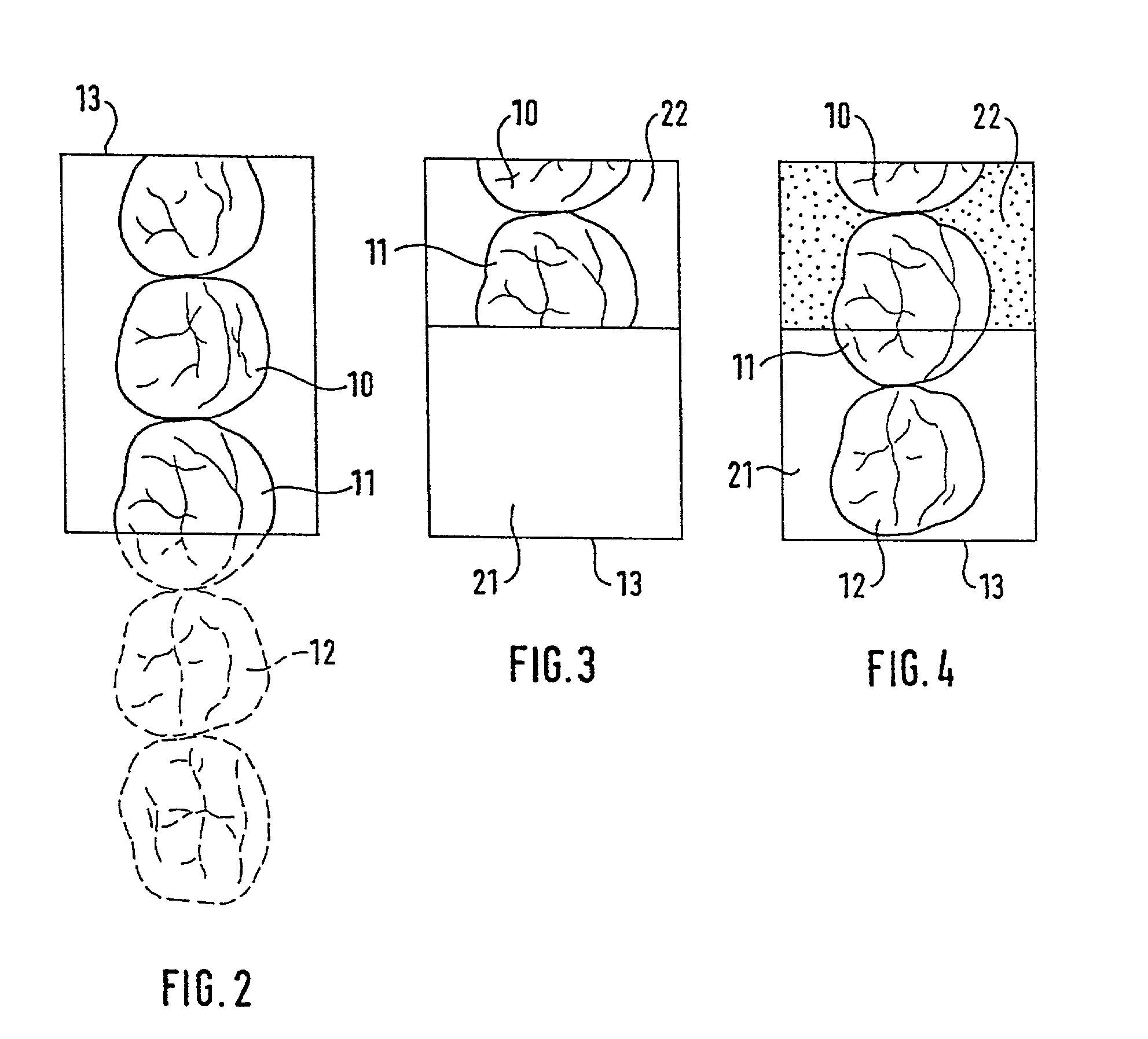 Method for detecting and representing one or more objects, for example teeth