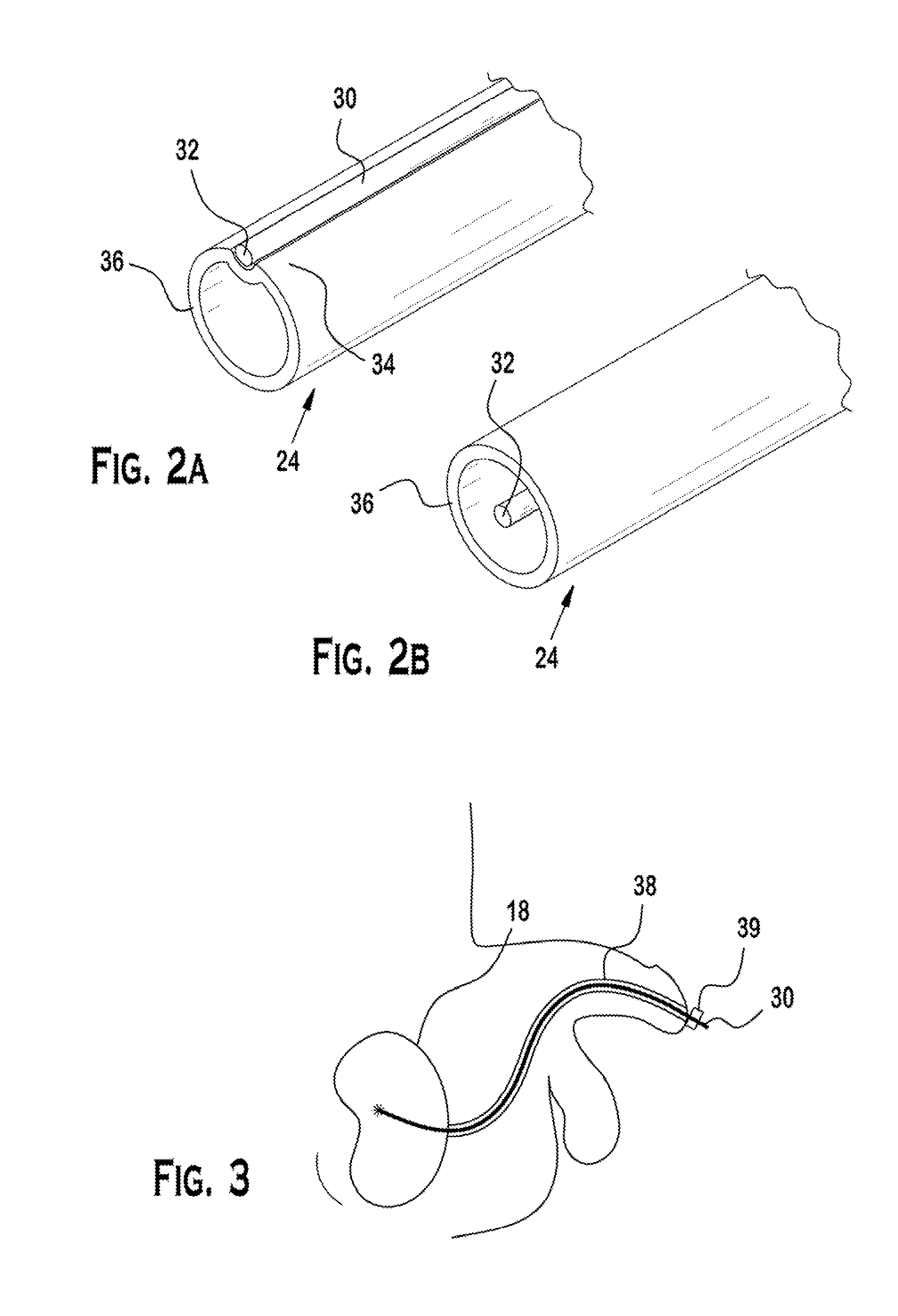 Interventional photoacoustic imaging system