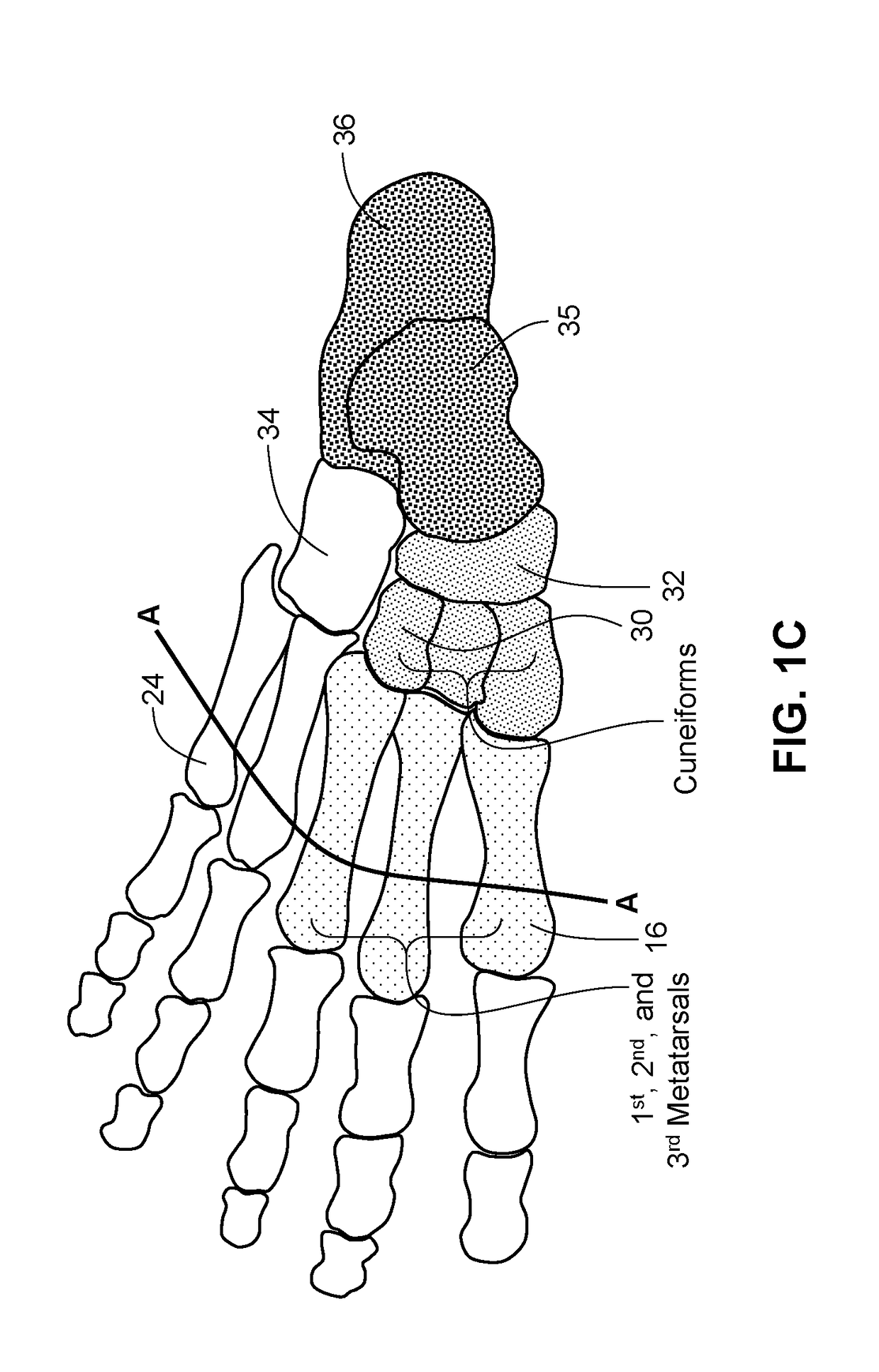 Methods and systems for sizing an orthotic device