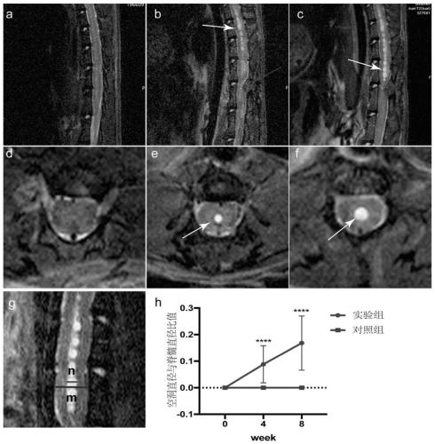 Reversible syringomyelia animal model, and construction method and application thereof