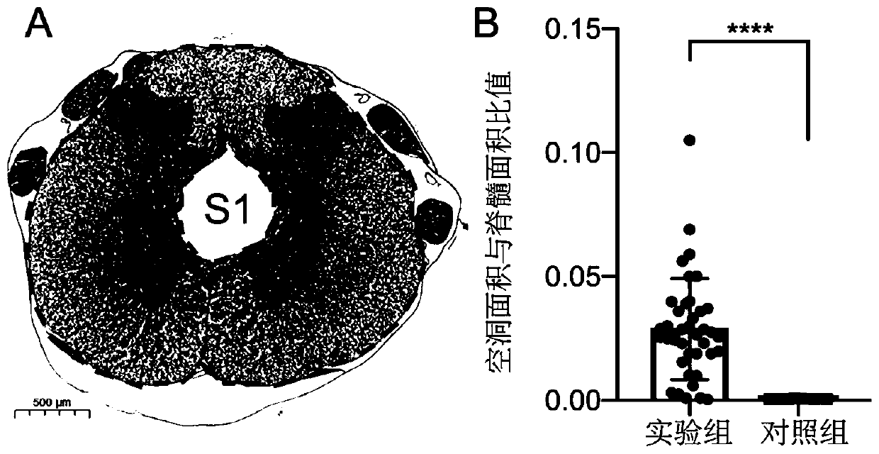 Reversible syringomyelia animal model, and construction method and application thereof