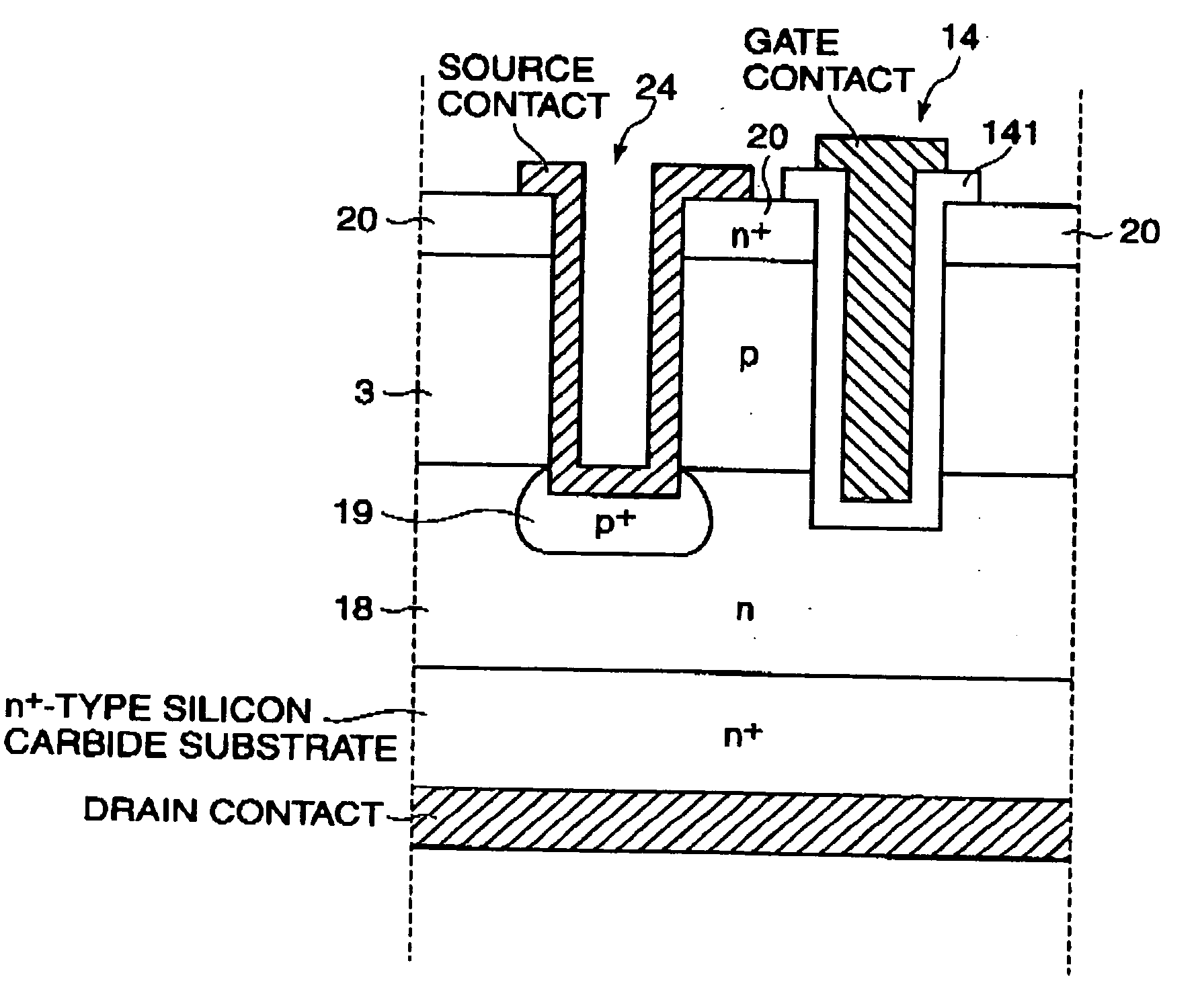 Silicon carbide semiconductor device