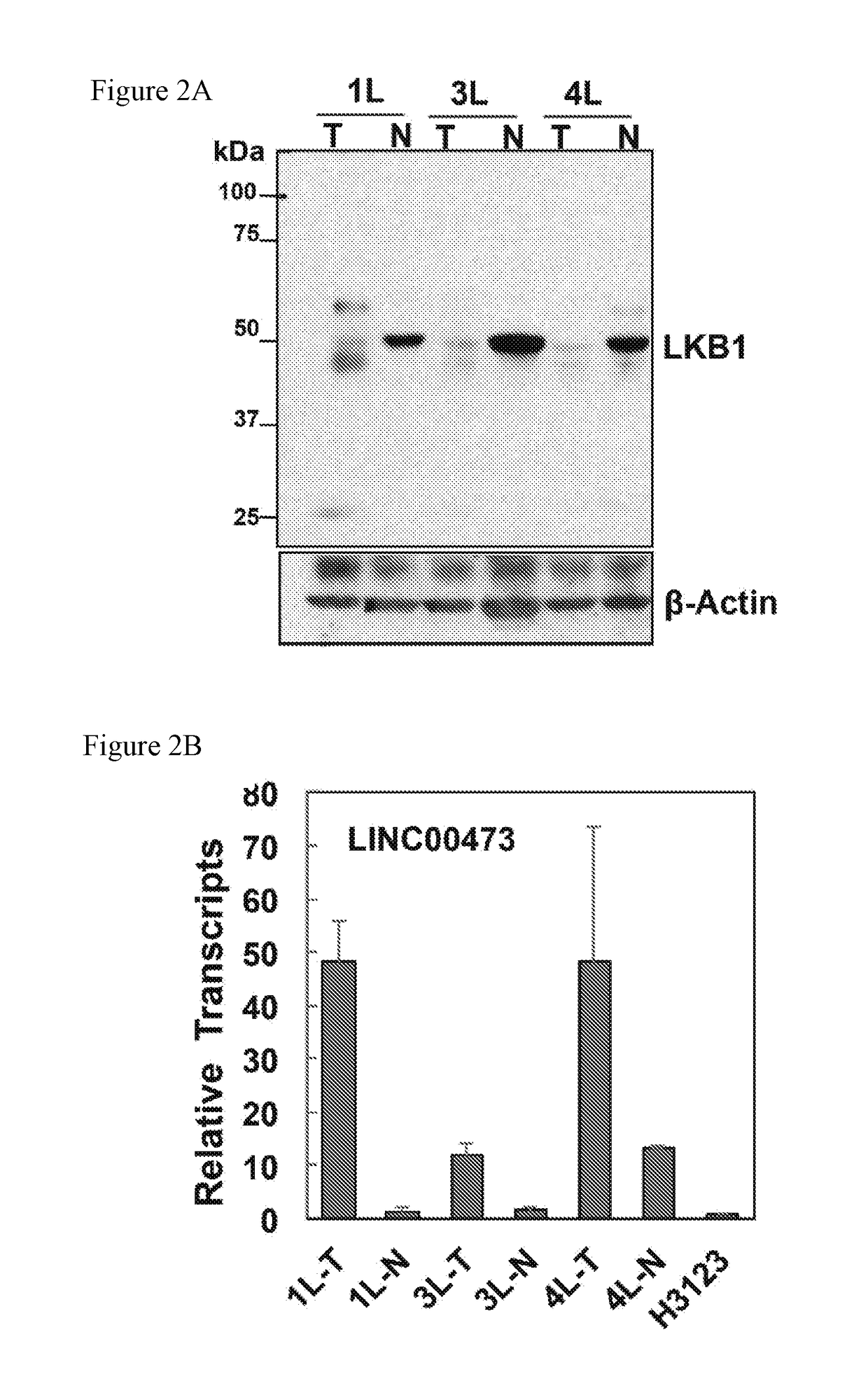 Lncrna serves as a biomarker and therapeutic target