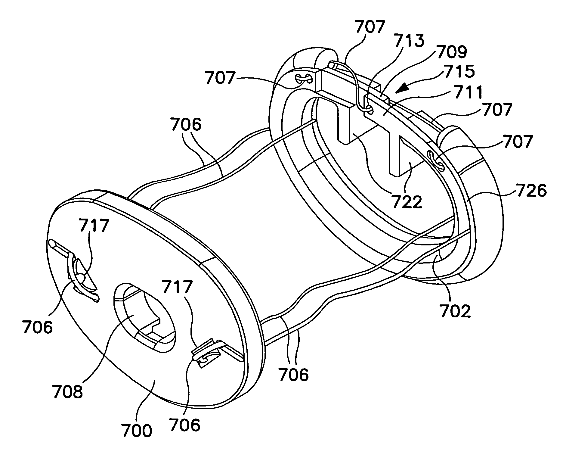 Annuloplasty system