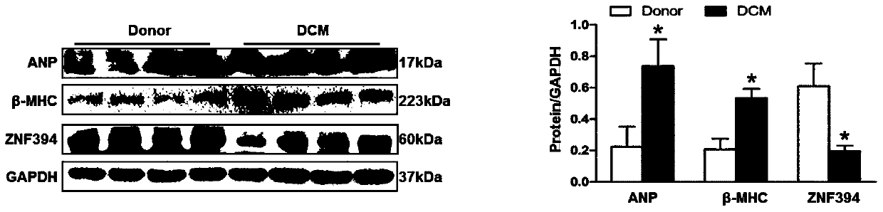 Application of zinc finger protein 394 (znf394) in the treatment of cardiac hypertrophy