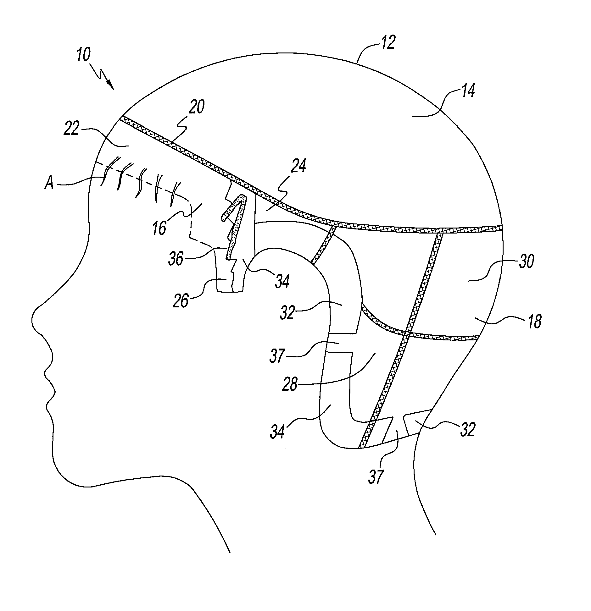 Medical hair prosthesis system