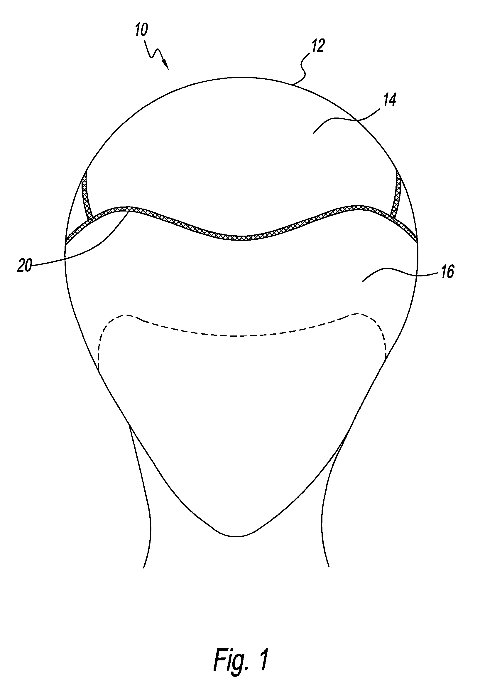 Medical hair prosthesis system