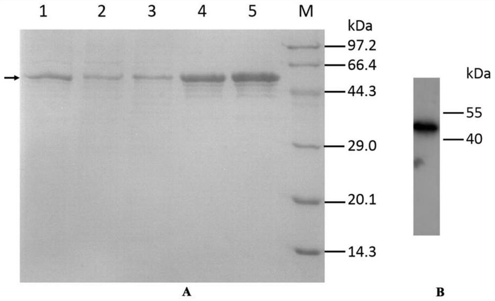 Camelid-derived nanobodies capable of specifically binding to carbonic anhydrase IX and applications thereof