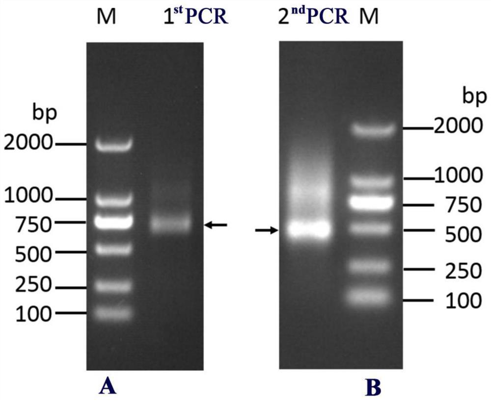 Camelid-derived nanobodies capable of specifically binding to carbonic anhydrase IX and applications thereof