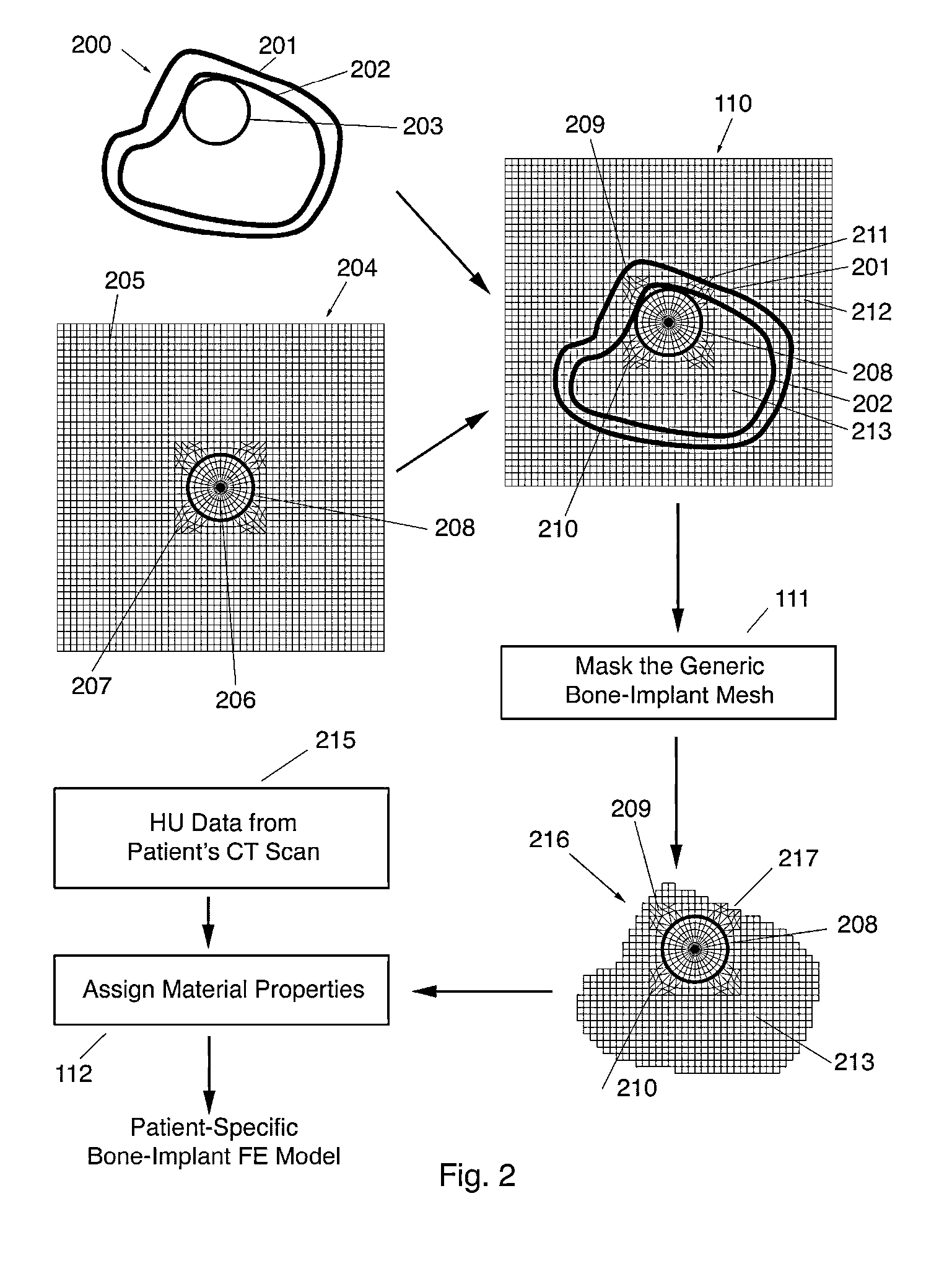 Automated patient-specific bone-implant biomechanical analysis